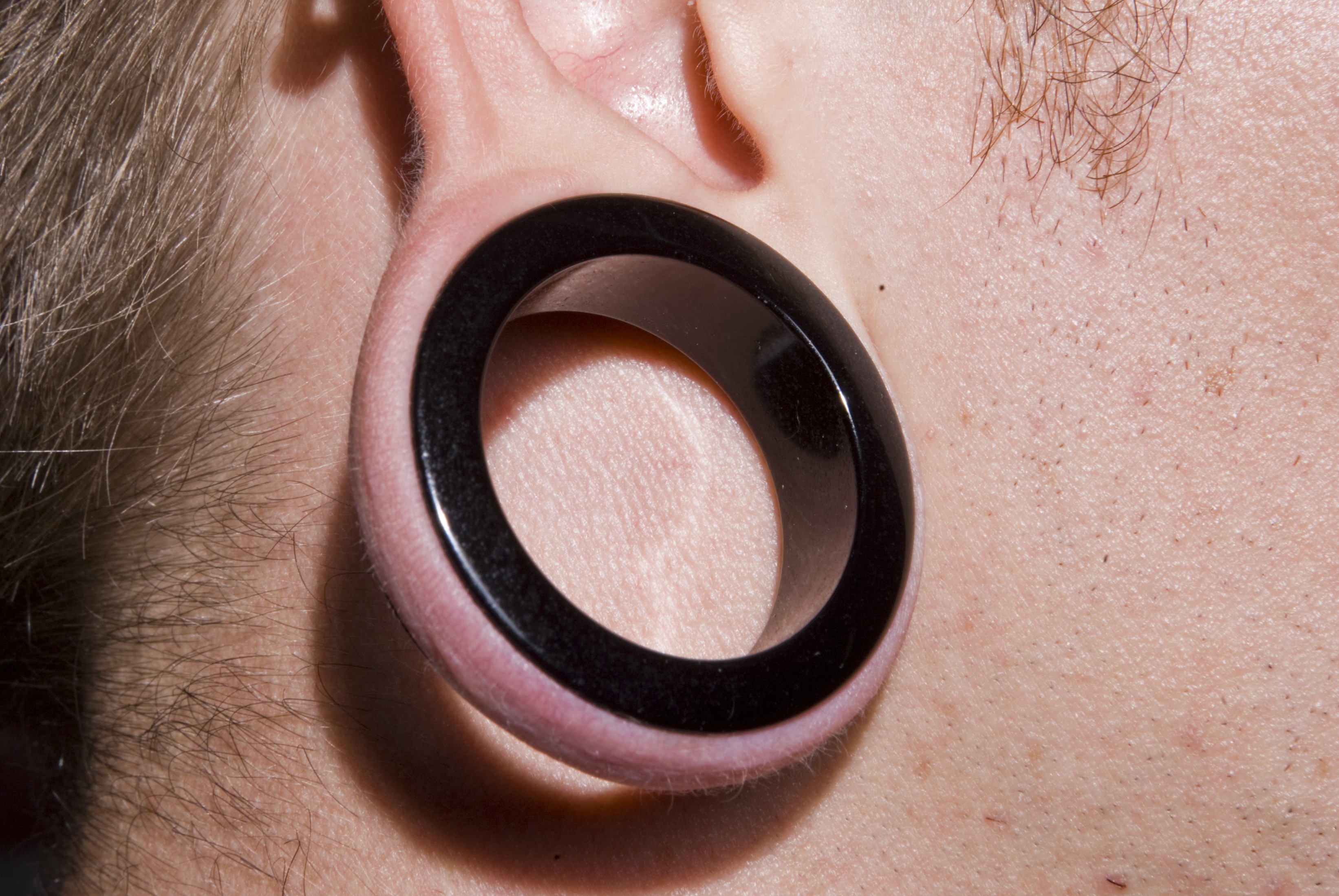 Fixing Earlobe Holes Made by Disc 